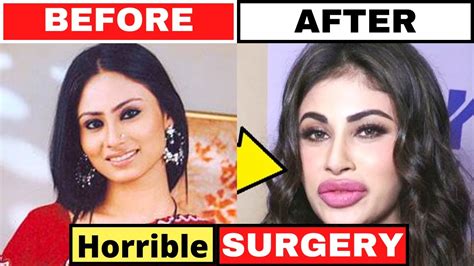 SHOCKING Plastic Surgery Of Bollywood Actresses BEFORE AFTER Part 2