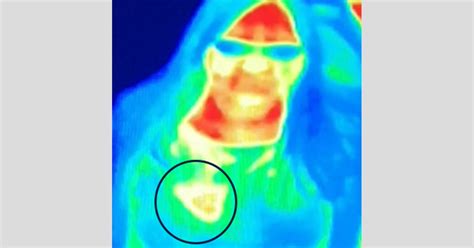 Woman Says Thermal Camera Spotted Breast Cancer Not So Fast Experts Say