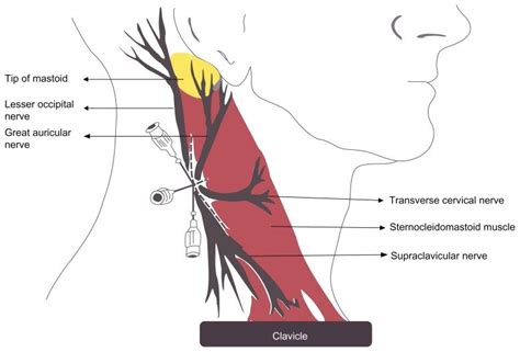 Anatomy Of Superficial Cervical Plexus Of Neck Notes Needle Insertion