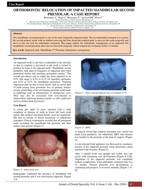 Pdf Orthodontic Relocation Of Impacted Mandibular Second Premolar A