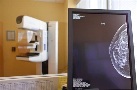 Breast Imaging Radiology Penn Medicine