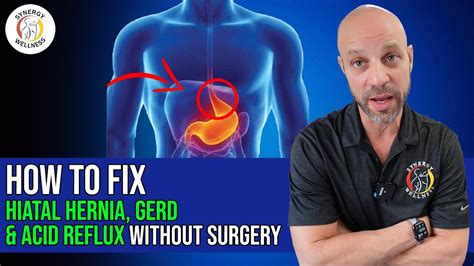 How To Fix A Hiatal Hiatus Hernia Gerd Acid Reflux Without Surgery Youtube