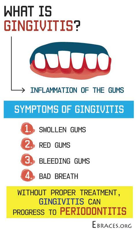 How To Cure Gingivitis Naturally These 7 Best Ways