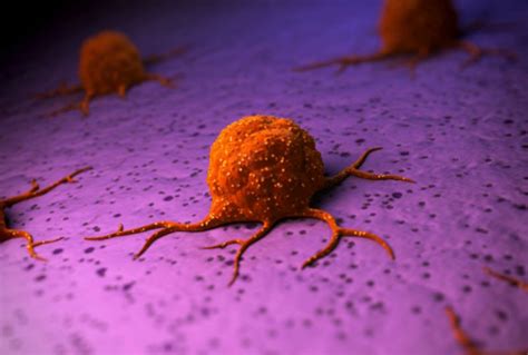 Researchers Discover New Way To Destroy Cancer Cells Finchannel