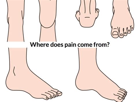 Locating Foot Pain Consulting Footpain