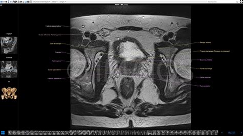 Pelve masculina IRM atlas da anatomia da próstata da bexiga dos órgãos genitais e do reto