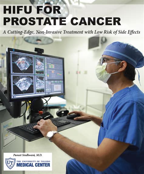 HIFU For Prostate Cancer Healthy Living News