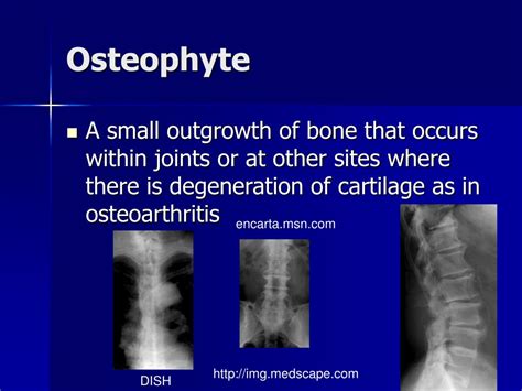Ppt Diagnostic Radiology Iii Definitions Powerpoint Presentation