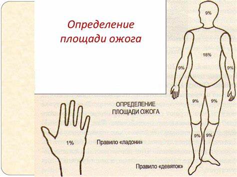 Термическая, химическая, радиационная и электротравма - online presentation Картинка - Термическая, химическая, радиационная и электротравма - online presentation