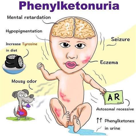 Fenilcetonuria PKU Neurologie Pediatrica