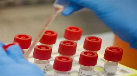 Antigenní testy jsou rychlé, nemusí ale odhalit všechny. COVID-19: Triple antigen test to be started in Rourkela ...
