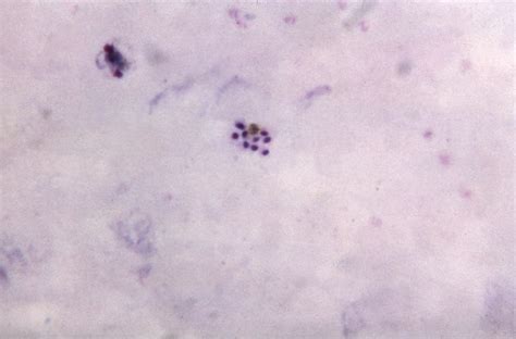 Kostenlose Bild Zwei Malaria Parasiten Vivax Ovale Rezidivierende Krankheit