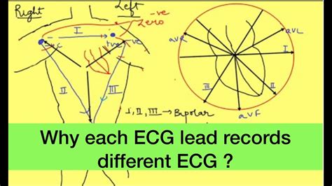 Ecg Leads Placement Ekg Unipolar And Bipolar Limb Ecg Leads