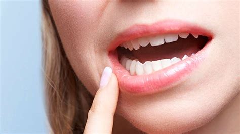 Swollen Gums Possible Causes And Treatments Solar Dental And Orthodontics