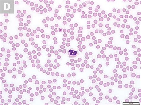 I'd speak to the vet and ask what the prognosis is, or just ask what the test result means and if there will have to be more blood tests done. Blood Smear Platelet Evaluation & Interpretation ...