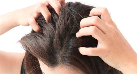 10 Most Common Causes Of Scalp Infections Facty Health