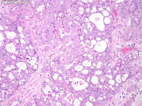 A Collection Of Surgical Pathology Images