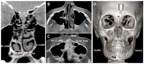 Applied Sciences Free Full Text A Cbct Evaluation Of Nasal Septal
