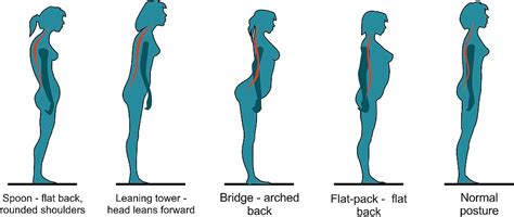 Noozyes Are You A Spoon Or A Bridge Your Posture Determines Whether