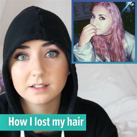 How I Lost My Hair How I Lost My Hair By Hannah Forcier