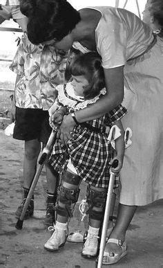 Pin By Dianne Dych On Polio Pinterest Braces Legs And Medical