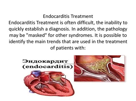 The Treatment Of Rheumatic Endocarditis презентация онлайн