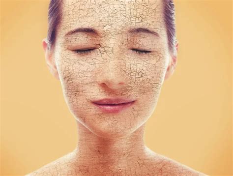 Woman With Dry Skin Stock Photos Royalty Free Woman With Dry Skin