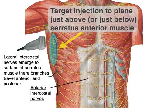 Pecs Serratus Highland Em Ultrasound Fueled Pain Management