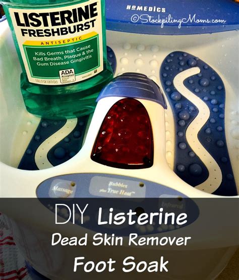 Diy Listerine Dead Skin Remover Foot Soak