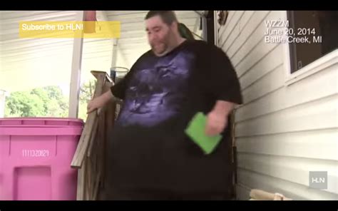 Man With Abnormally Large Scrotum To Get Surgery Rochester Mi Patch