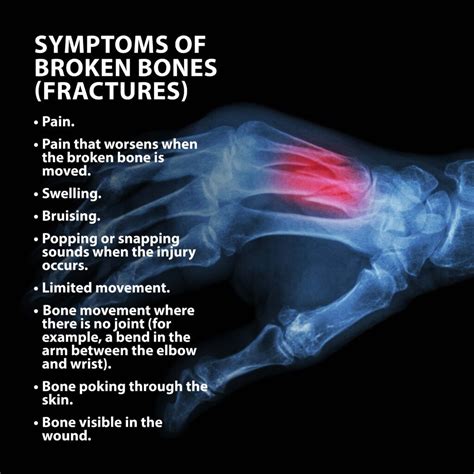 Sudden Acute Hand Injuries Florida Orthopaedic Institute