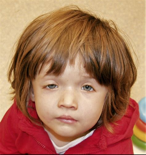 Der icd10 ist eine internationale klassifikation von diagnosen. Der diagnostische Blick - Ein 20 Monate altes Mädchen mit ...