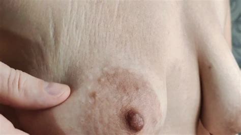 Closeup Saggy Tits With Stretch Marks Xxx Mobile Porno Videos