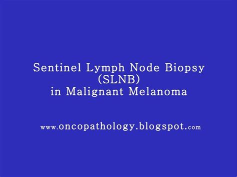 Melanoma Sentinel Lymph Node