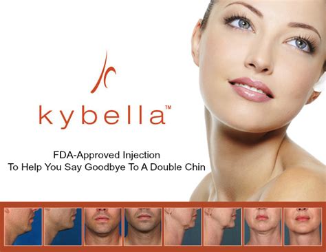 Advanced Bioidentical Hormone Therapy Kybella Treatments No More