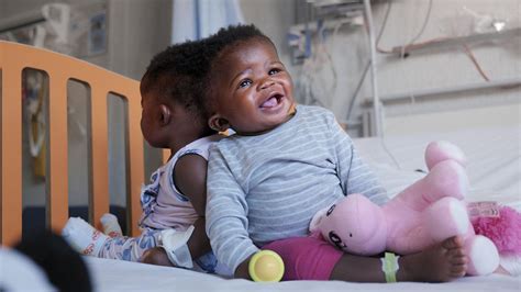 Twin Sisters Conjoined At The Head Successfully Separated By Surgery