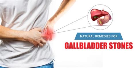 Natural Remedies For Gallbladder Stones Gall Bladder Stone Treatment