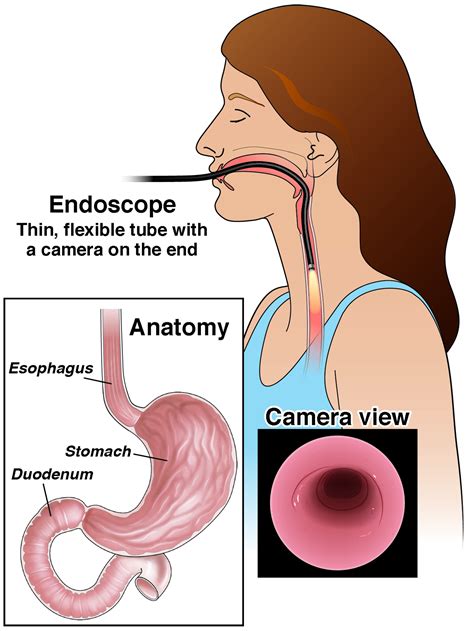 Endoscopy Upper Gi Aga Gi Patient Center
