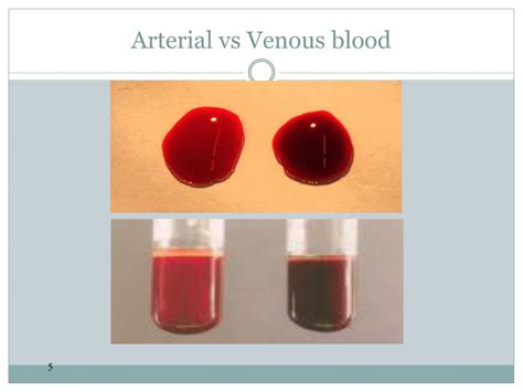 Arterial Blood Vs Venous Blood Color