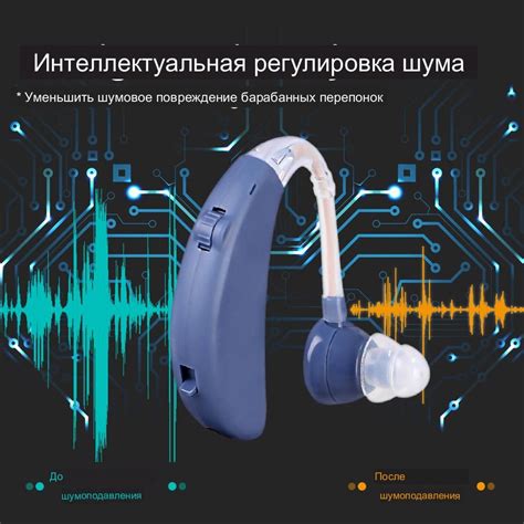 Удобные слуховые аппараты для пожилых людей - купить с доставкой по ...