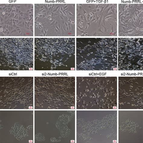 Numb Prrl Promoted Tgf β1 And Egf Induced Emt Like Cell Morphology In