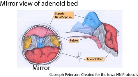 Anatomy Of Tonsils And Adenoids Anatomical Charts And Posters