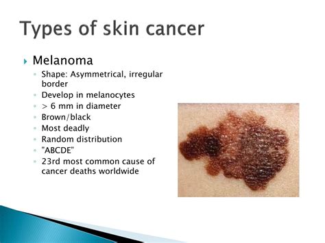 Types Of Skin Cancer Treatment