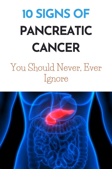 Pancreatic cancer often has a poor prognosis, even when diagnosed early. 10 Signs Of Pancreatic Cancer You Should Never, Ever Ignore