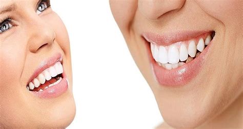 Five Tips For Preserving Naturally White Teeth Eastern Slope Dental