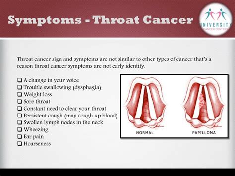 An early form of cancer of the larynx can be identified by an osseous voice. PPT - What is Throat cancer and it's Awareness ...