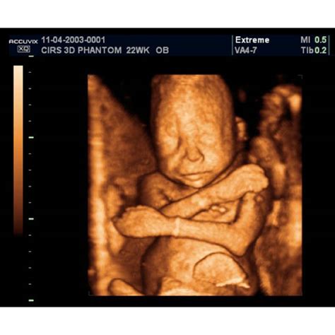 Fetal Ultrasound Training Phantom 20 Weeks Cirs 065 20