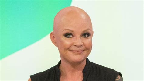 Gail Porter On Alopecia Bt