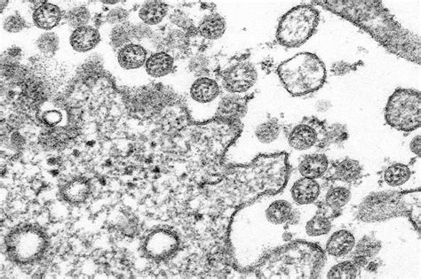 You can find locations for both viral and antibody tests on california's testing map. Gambar Virus Corona Hitam Putih Untuk Mewarnai - Gambar ...