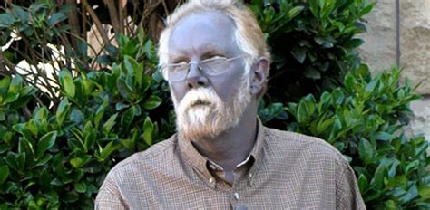 Internet Sensation Papa Smurf Dies Other Blue People Live On Abc News